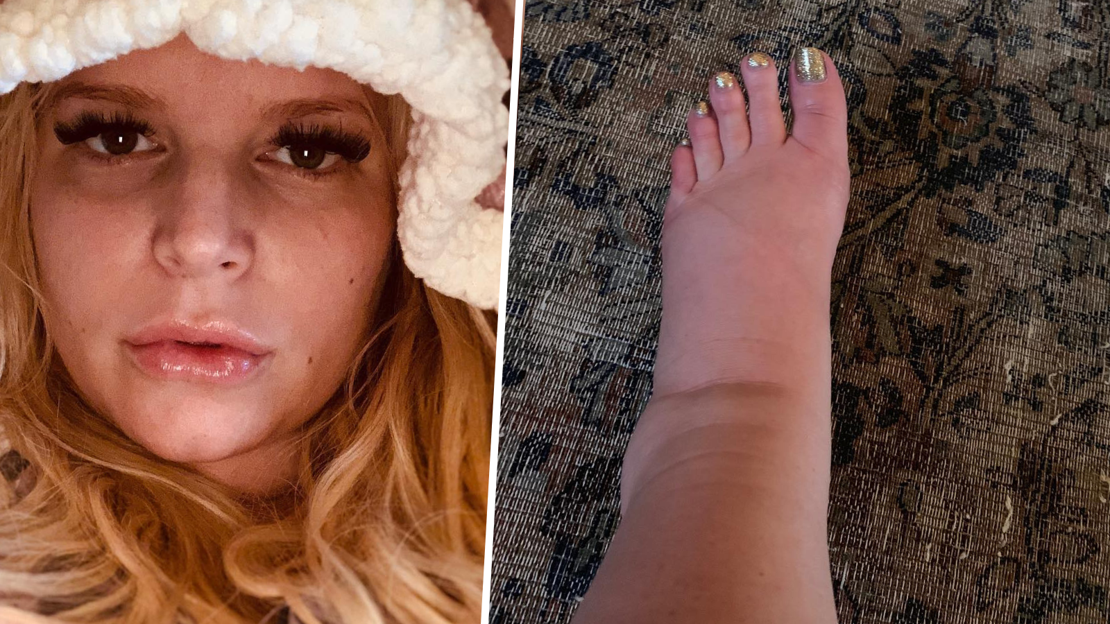 What To Do About Swollen Feet In Pregnancy